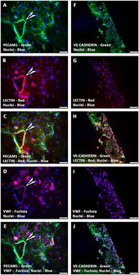 A Novel Human Tissue-Engineered 3-D Functional Vascularized Cardiac Muscle Construct